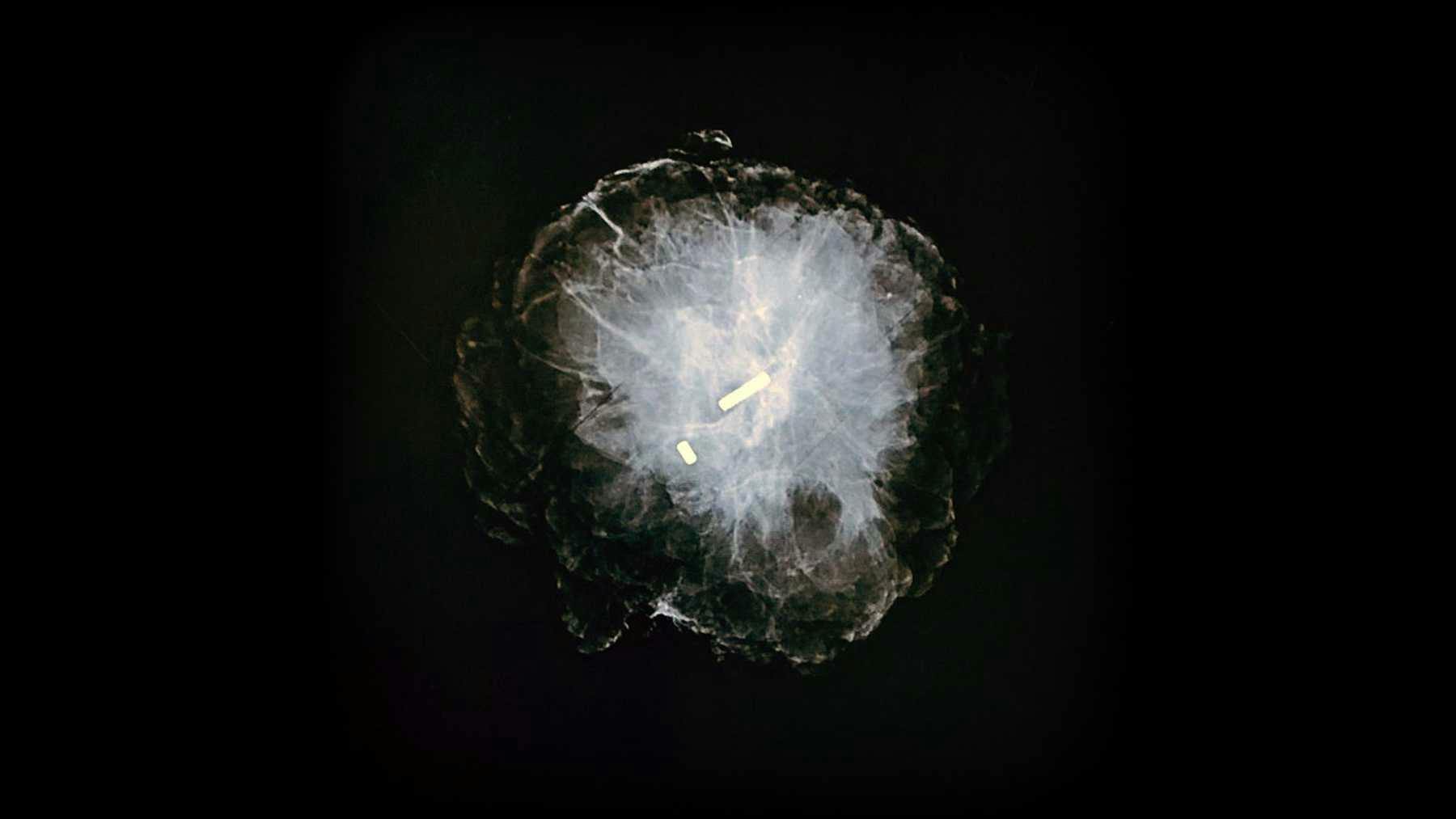 Magseed under imaging