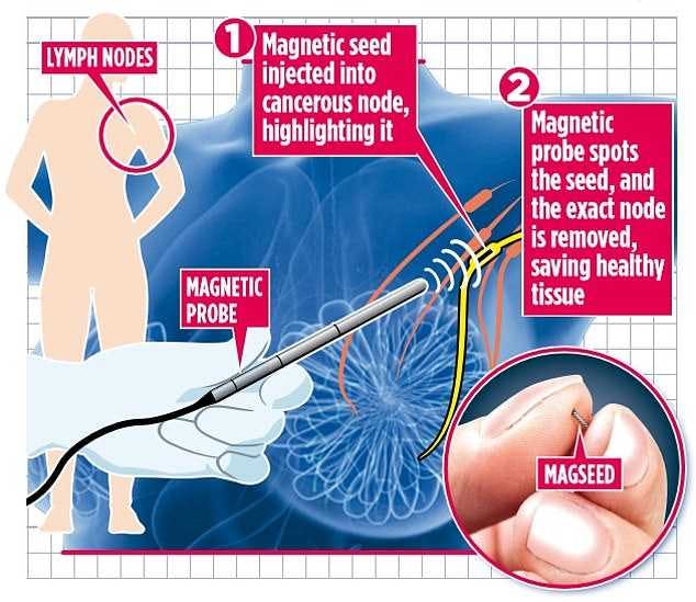 Graphic showing TAD procedure