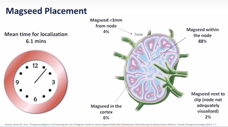 Symposium Mammographicum presentation slide