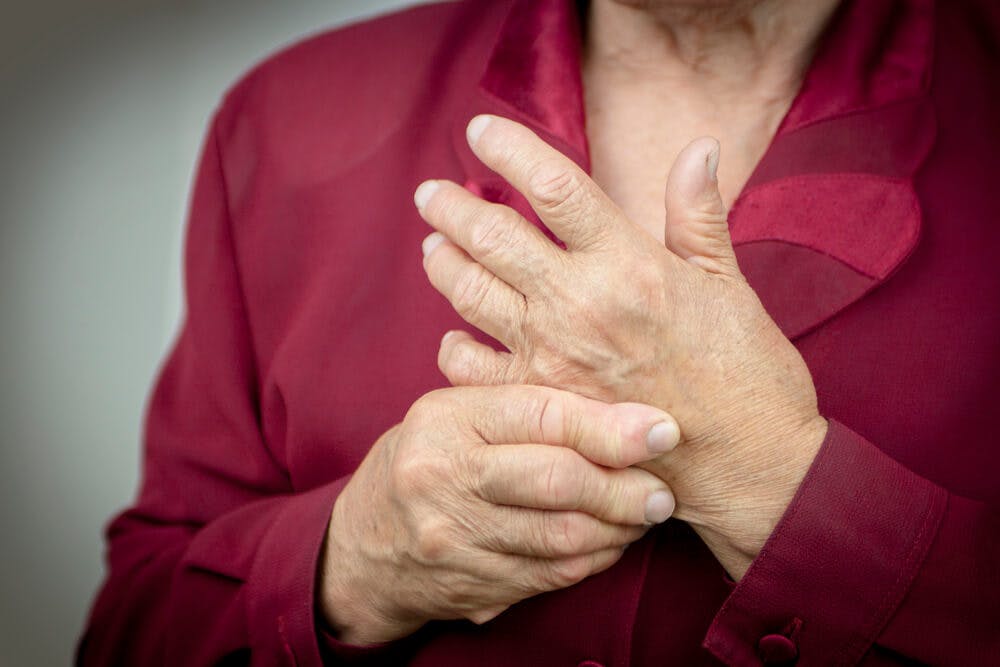 Cos'è l'artrite reumatoide? Ecco sintomi e cure