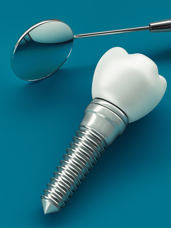 Formation DPC Dentiste - Les maladies péri-implantaires