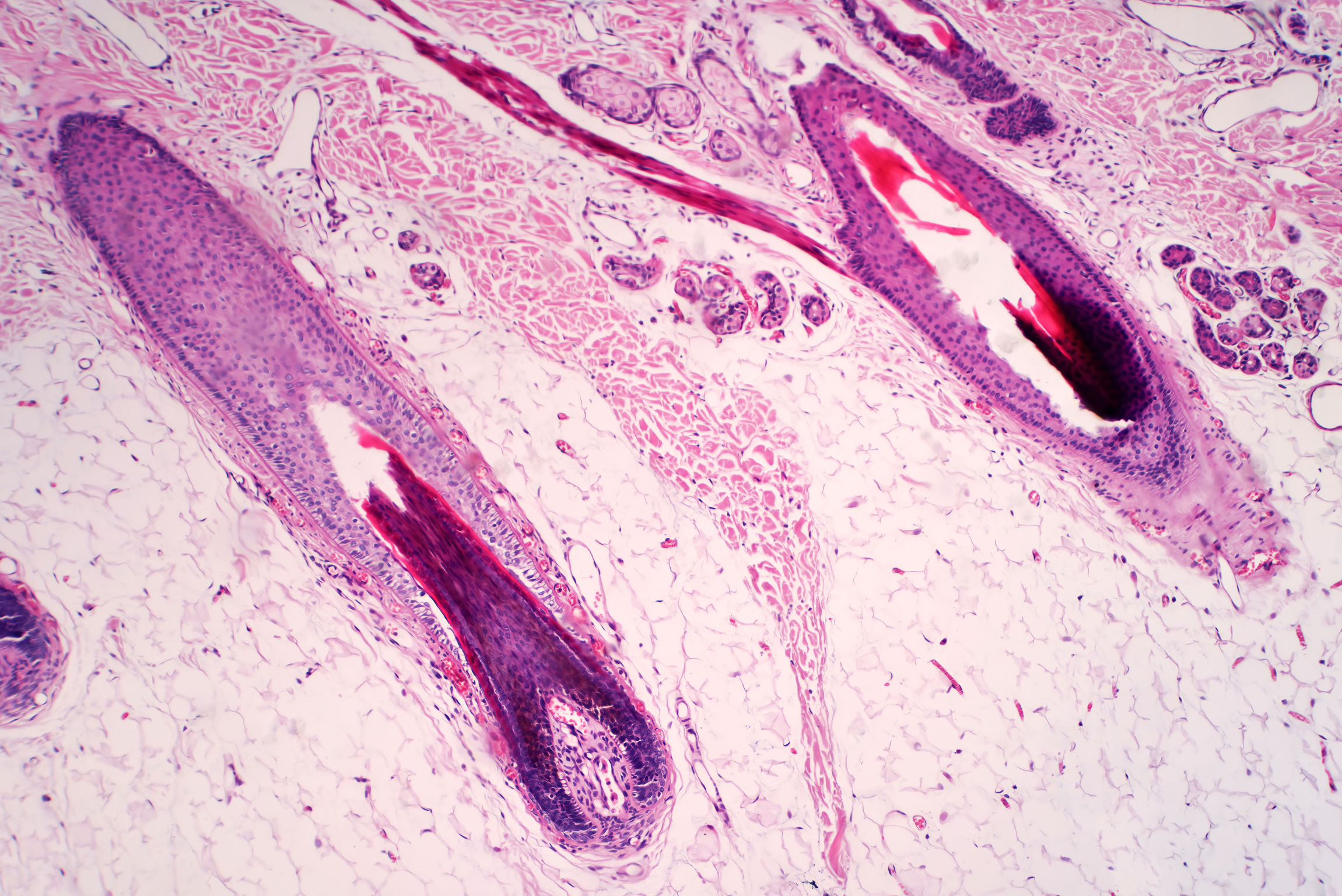 Can Damaged Hair Follicles Recover? Signs & What to Do