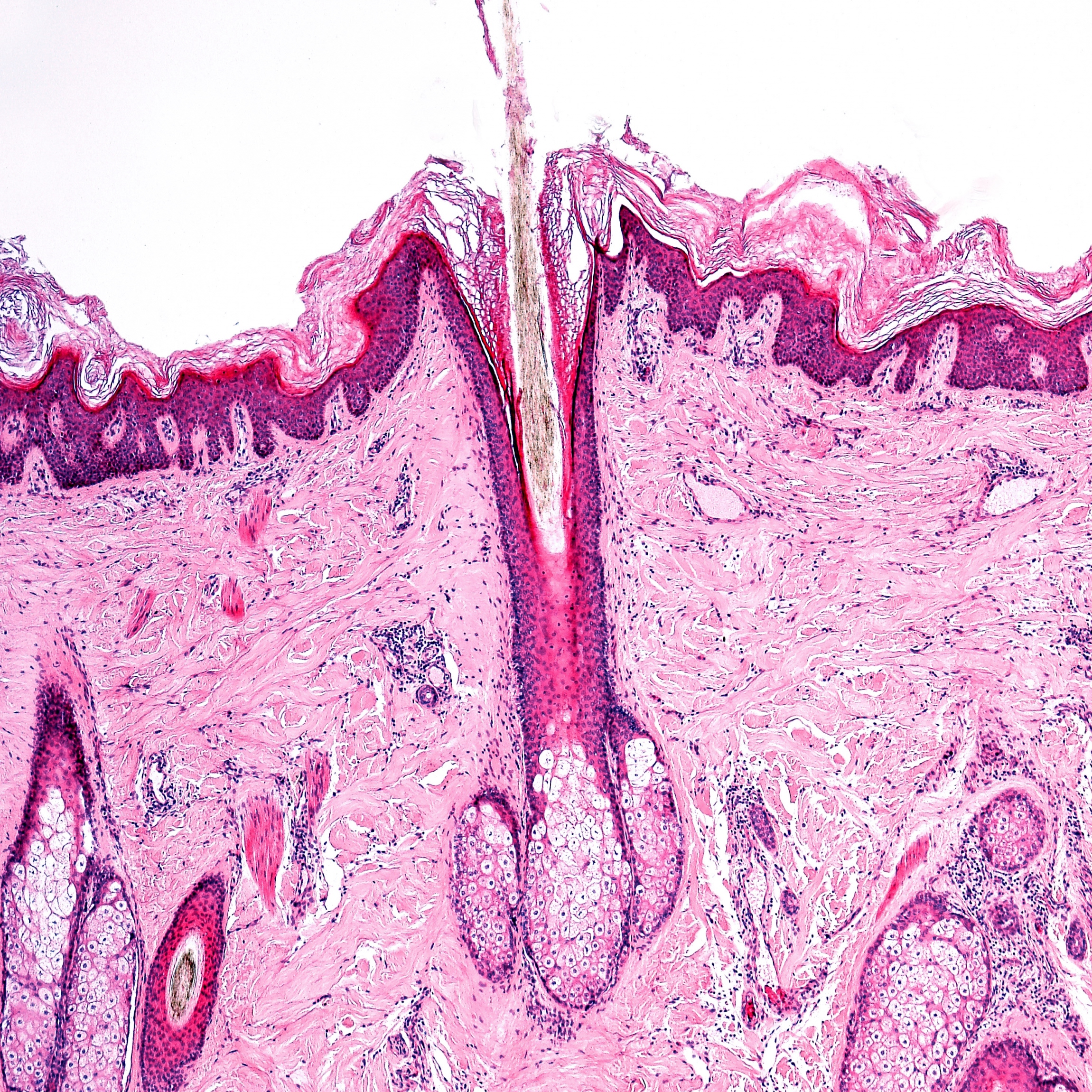 X-ray image of an individual hair follicle. 