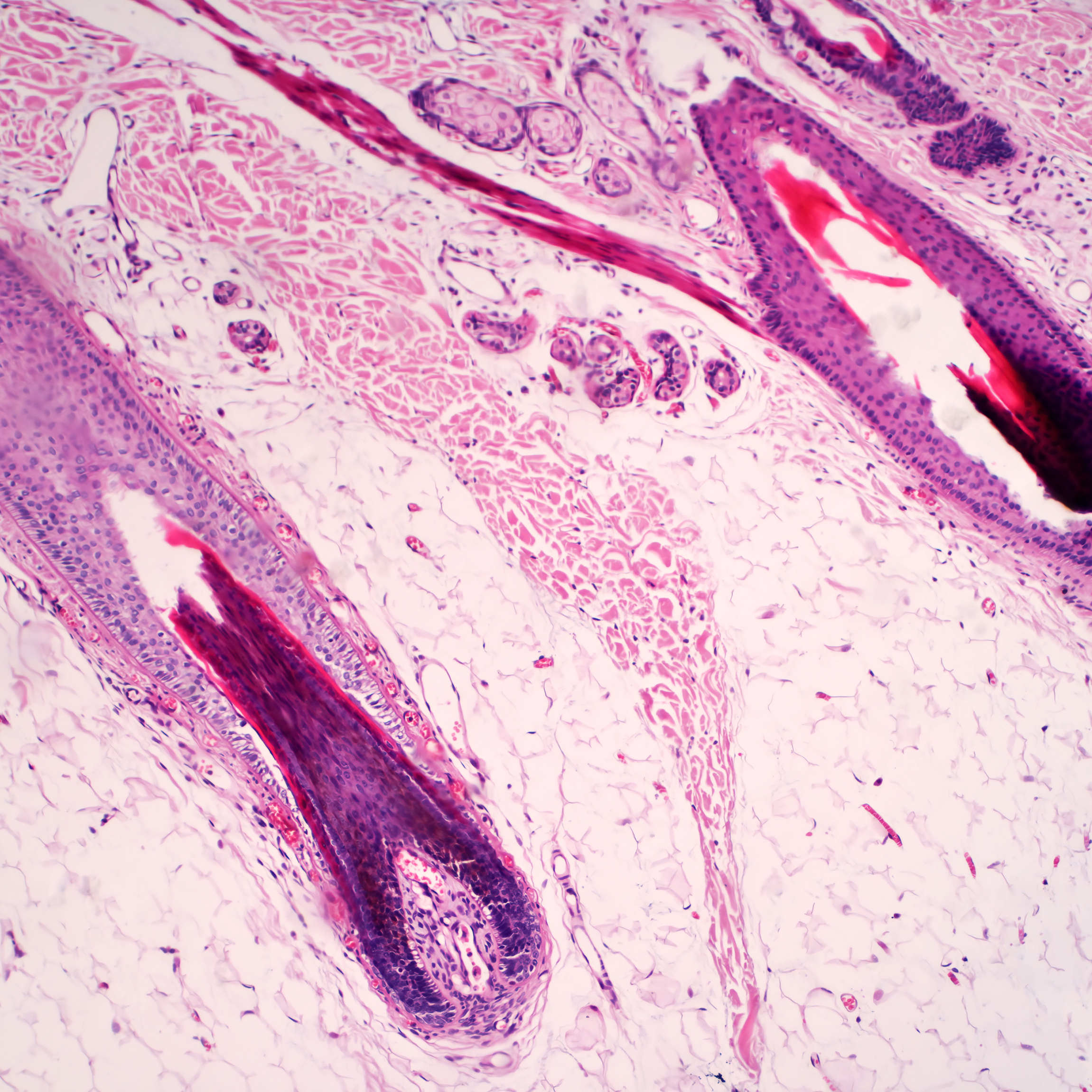 Microscopic image of a hair follicle. 