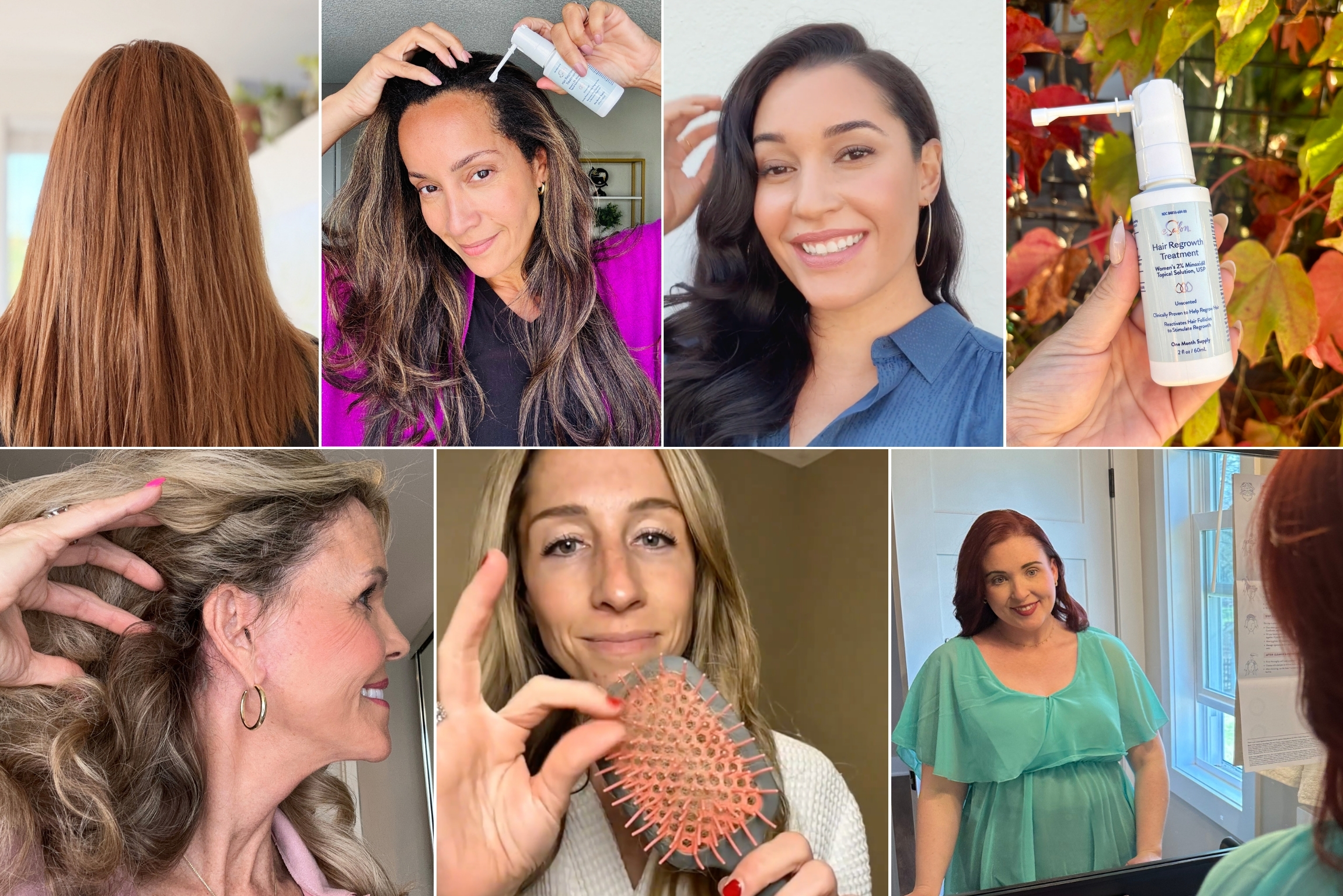 Your Minoxidil Questions, Answered