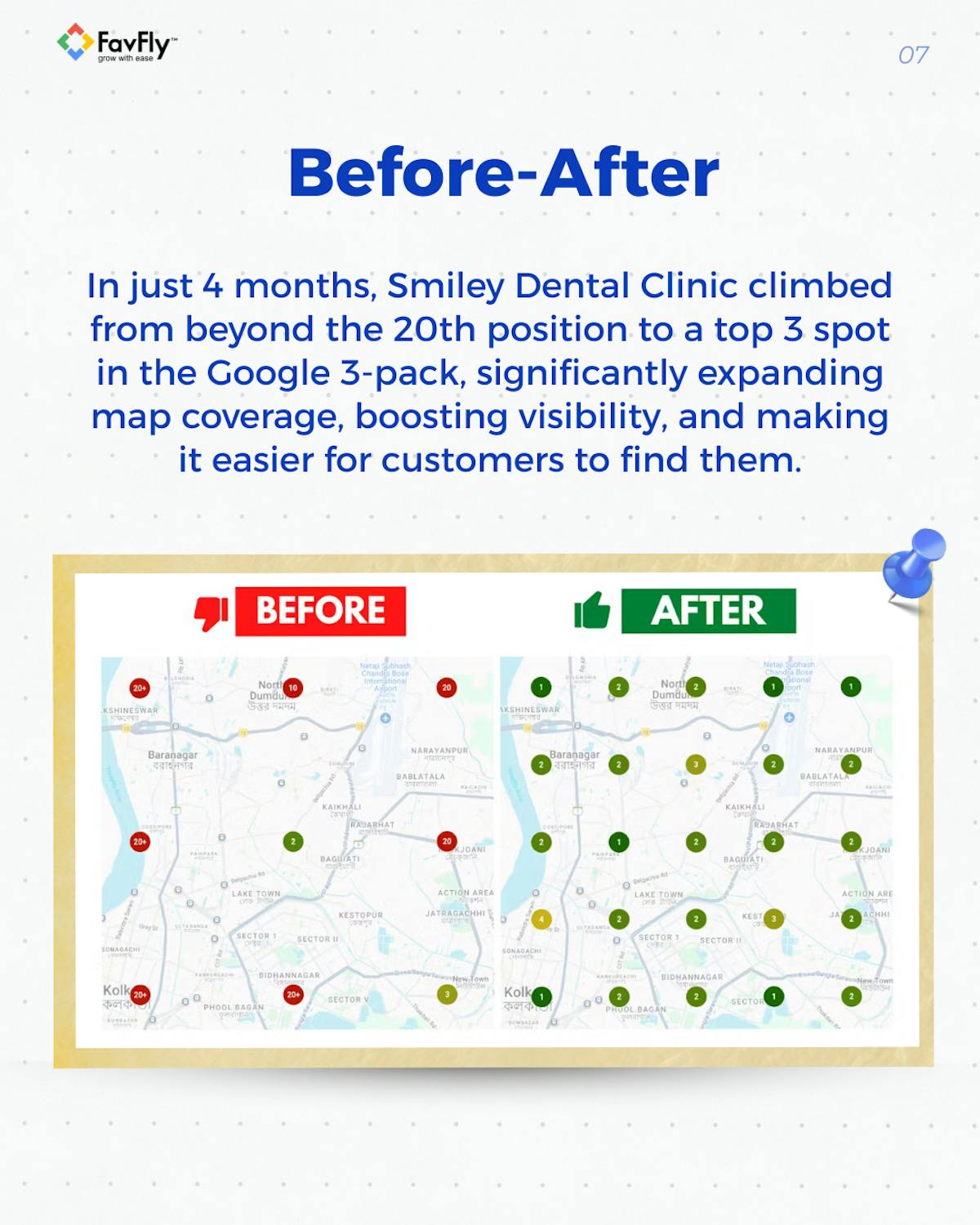 Before: inactive GBP, After: optimized dental profile