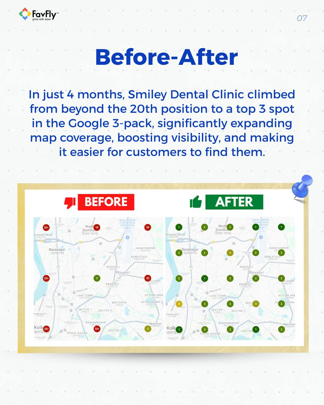 Before: inactive GBP, After: optimized dental profile
