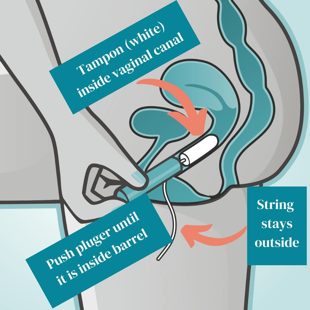 How To Insert Tampon