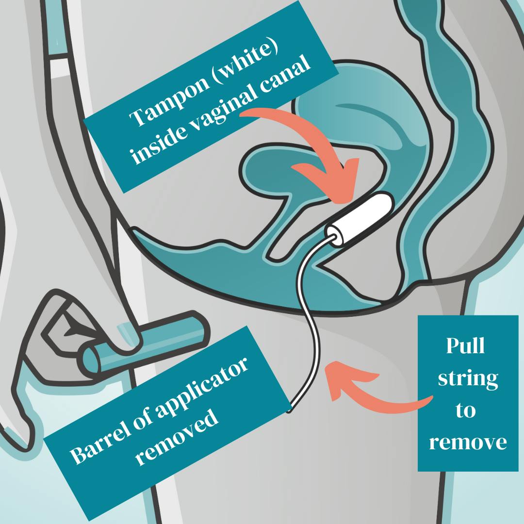 tampons insert