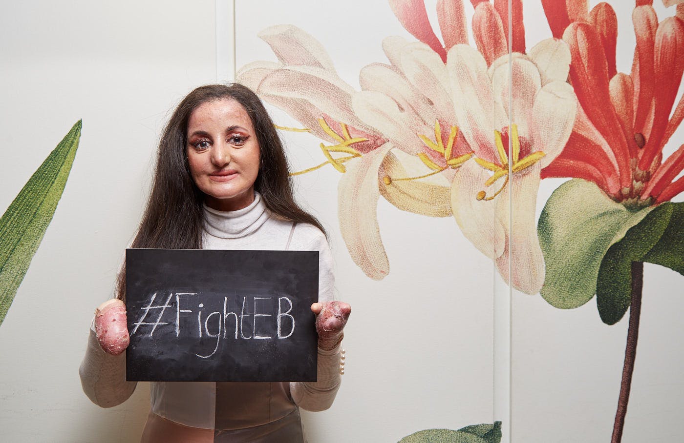 A girl holding a chalk board sign saying '#FightEB'. She is standing in front of a wall with a large flower design.