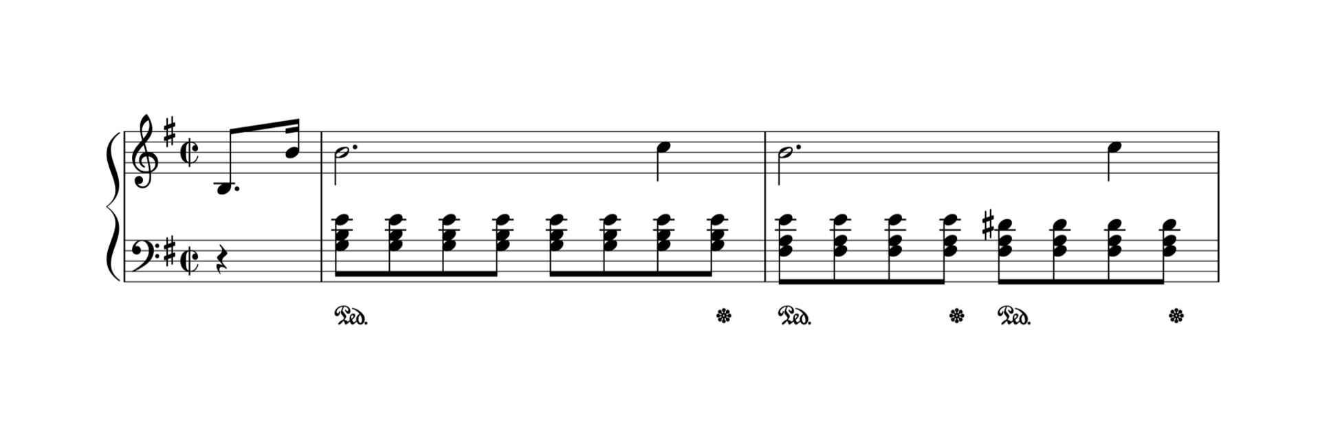 Piano Pedals » What do they do and how to use them flowkey