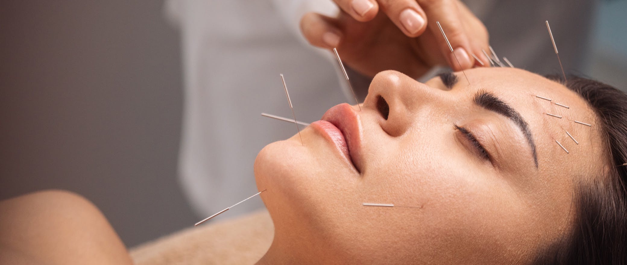 A close-up shot of an acupuncture specialist inserting needles into a female patient's face.