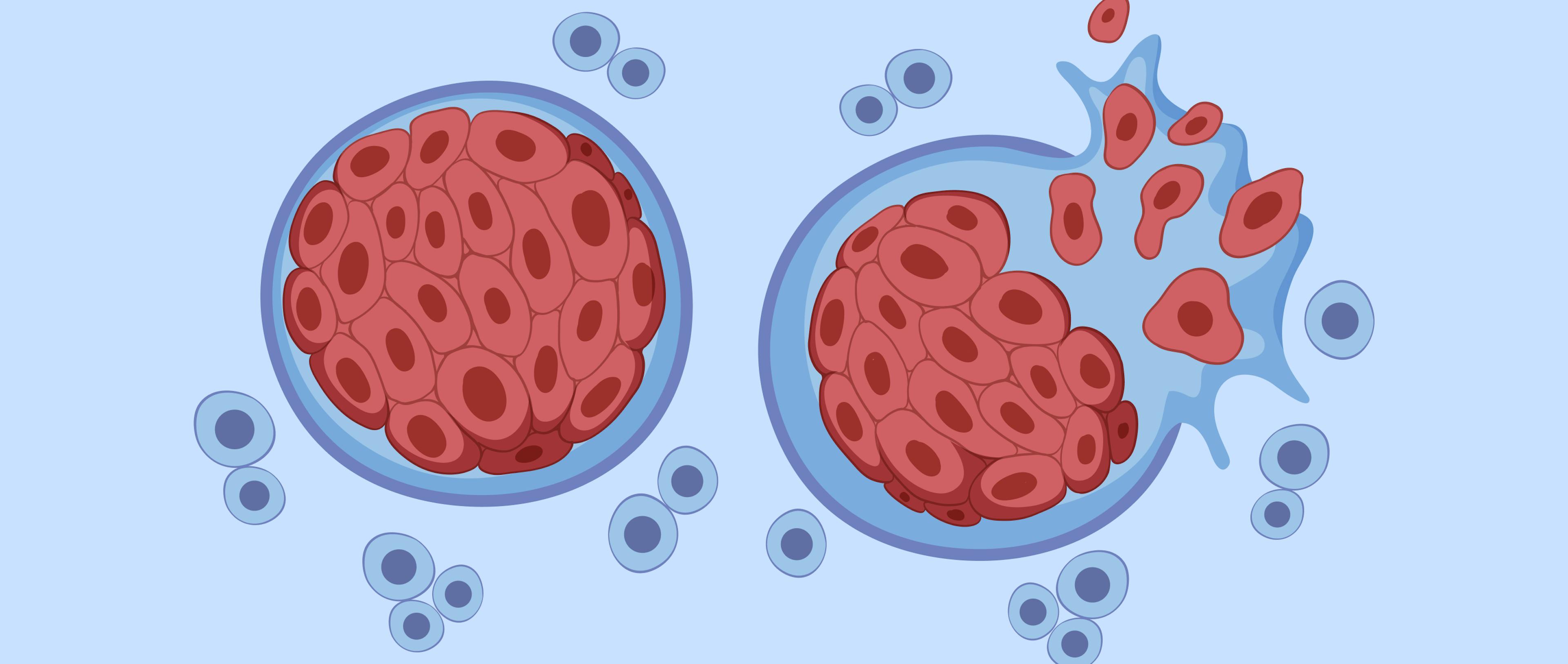 Tumor cell and cancer development