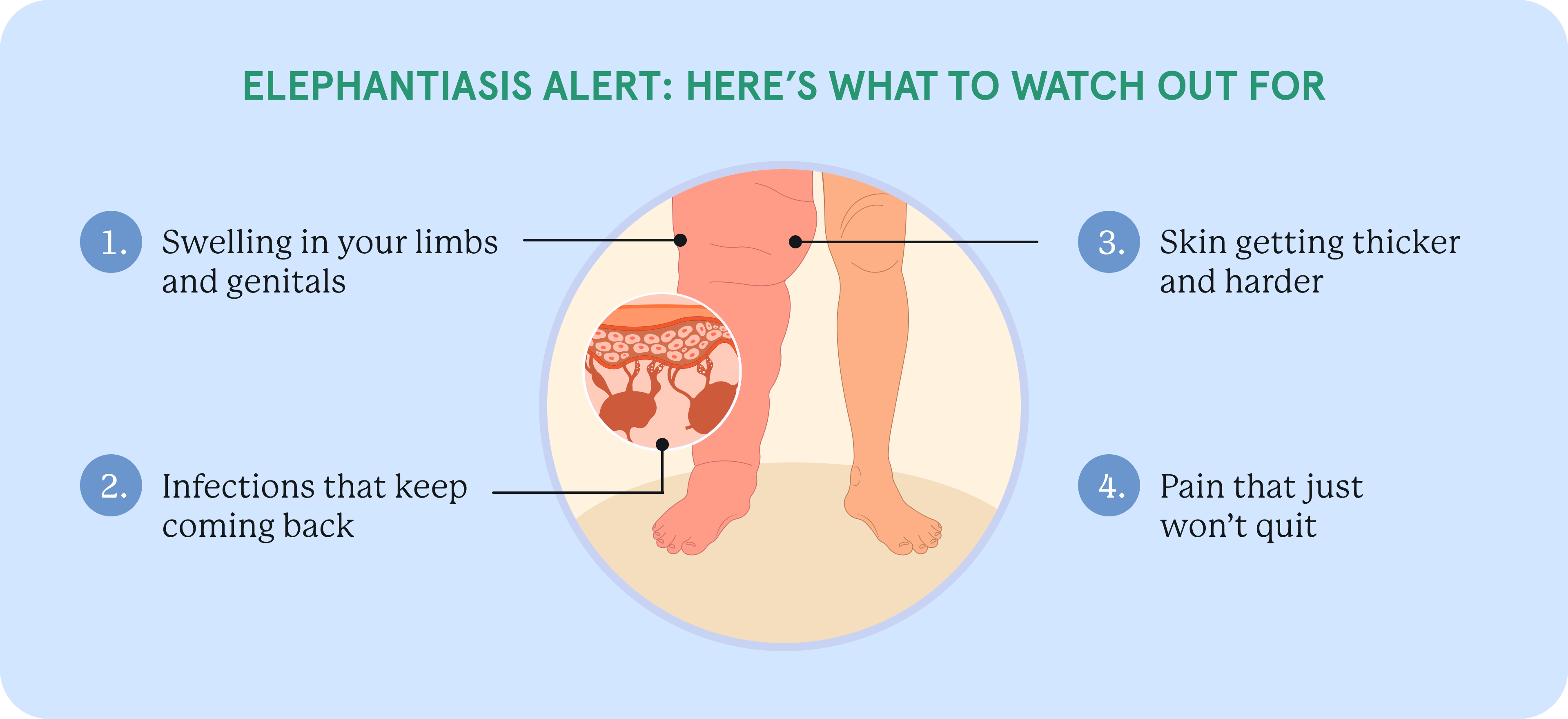 An infographic about a basic illustration of Elephantiasis.