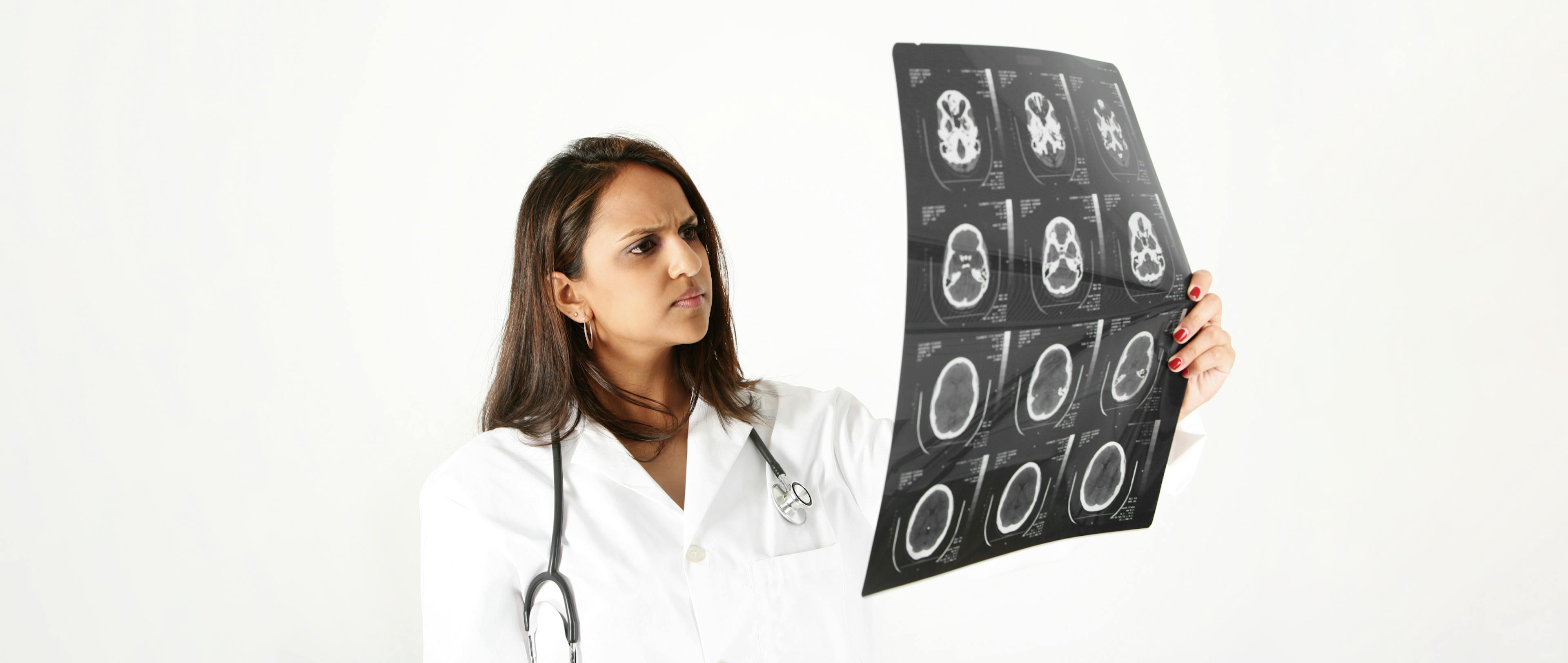 A woman doctor looking at a scan of a brain