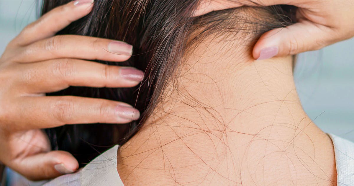 The Medical & Lifestyle Causes of Hair Loss | Fluent Health