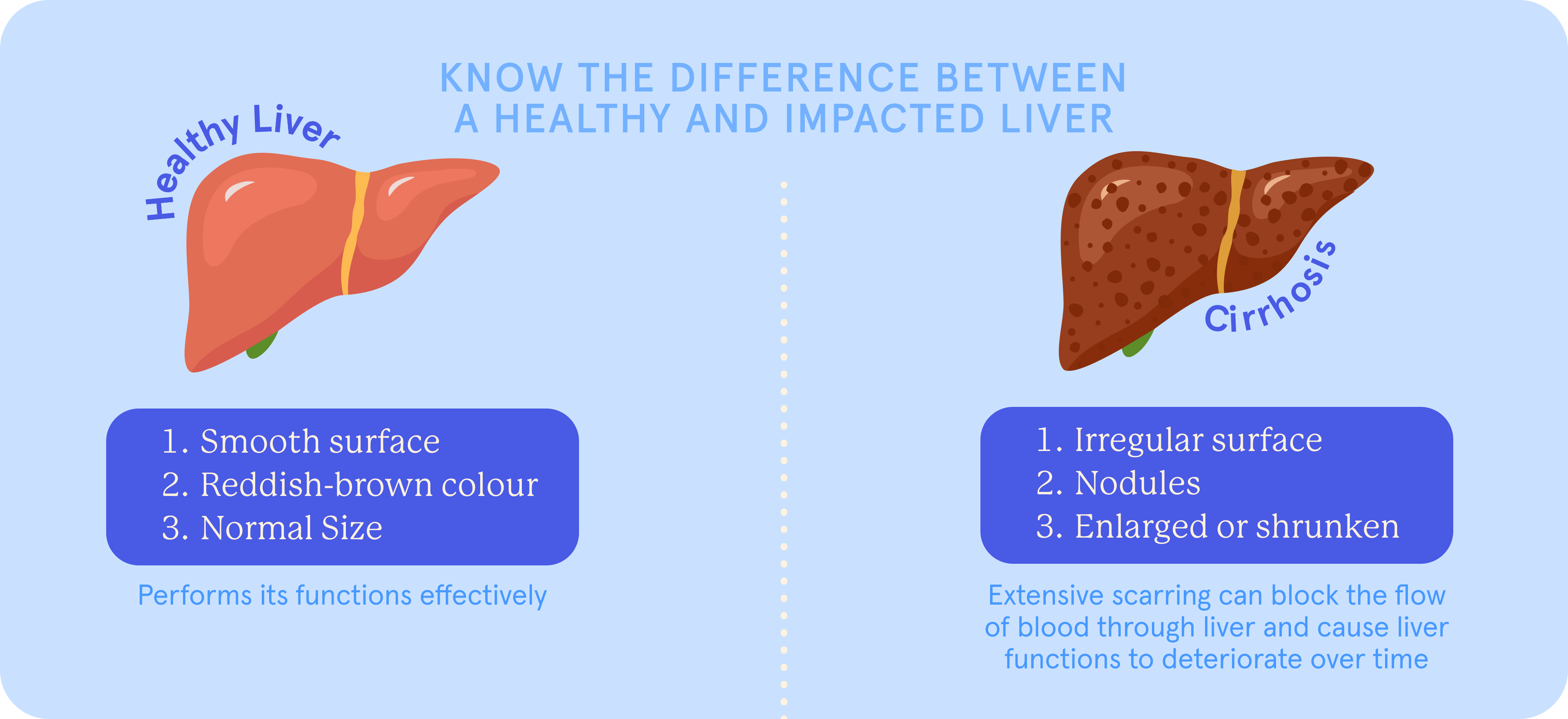A pictorial difference of a healthy and impacted liver 