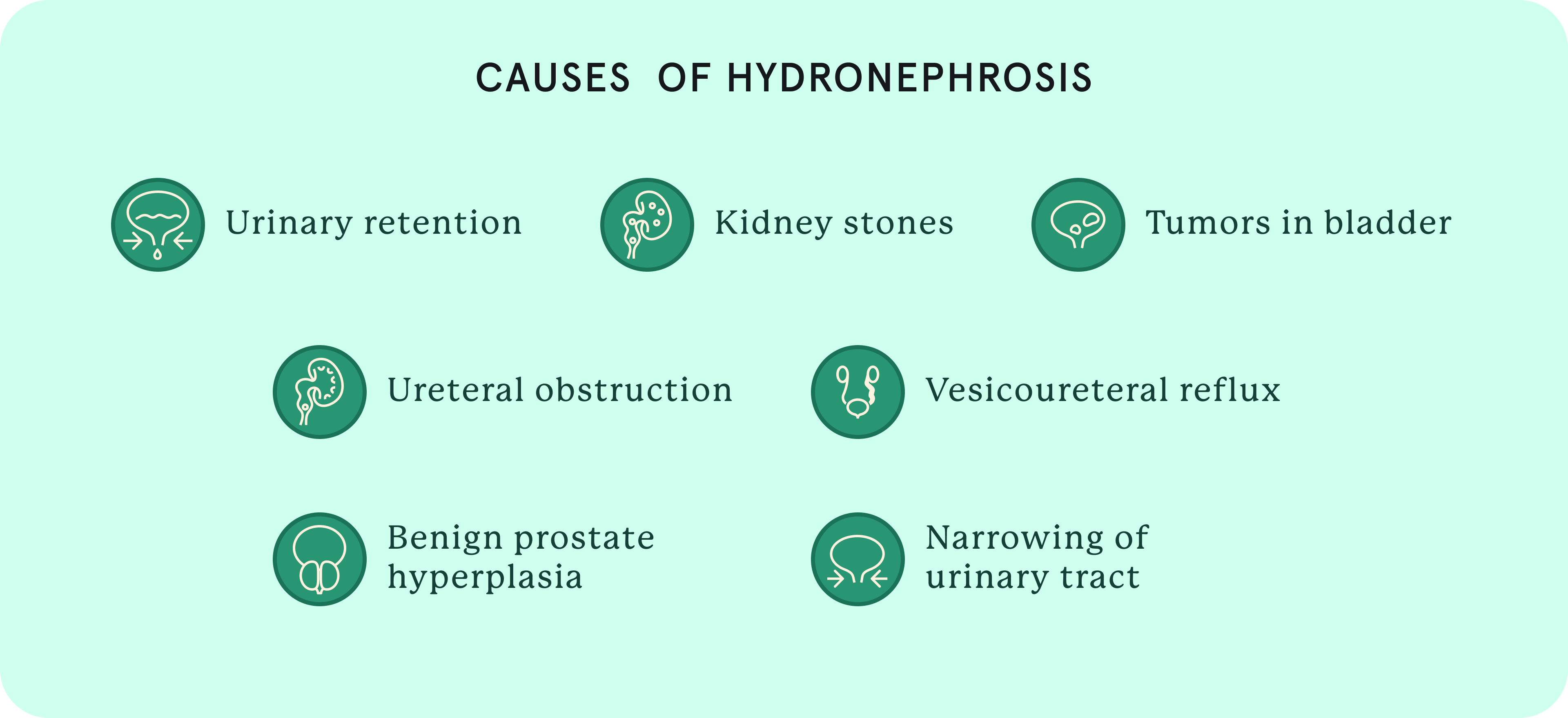 Causes of hydronephrosis