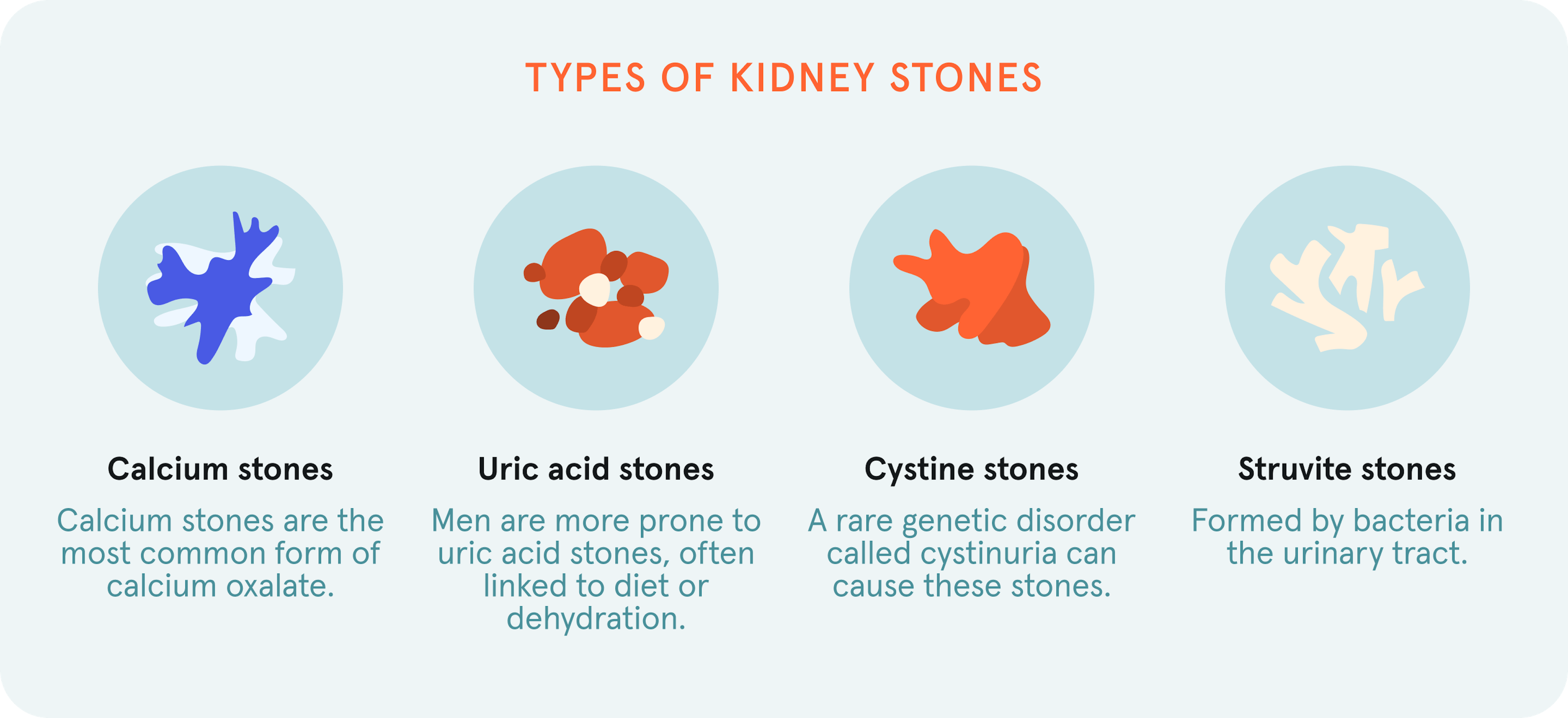 An infographic showcasing the different types of kidney stones