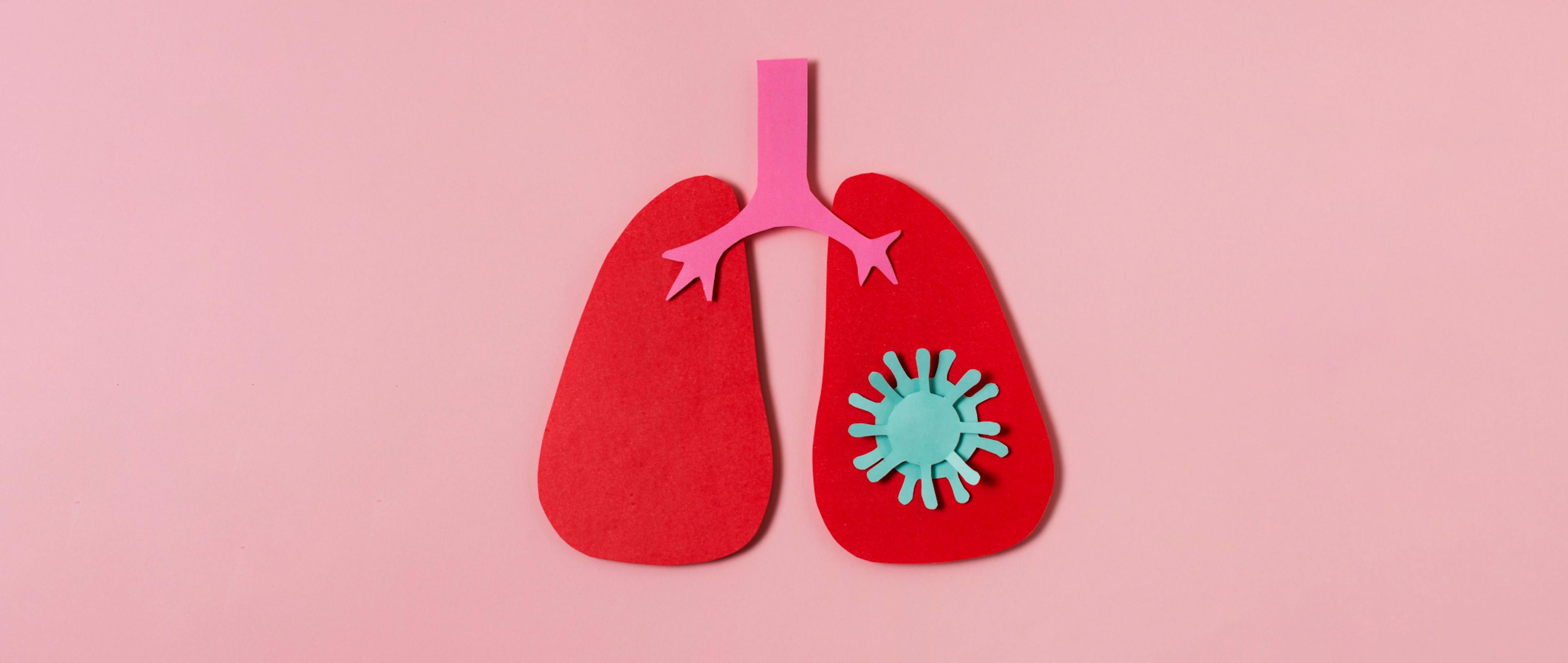 Everything You Need To Know About Lung Cancer