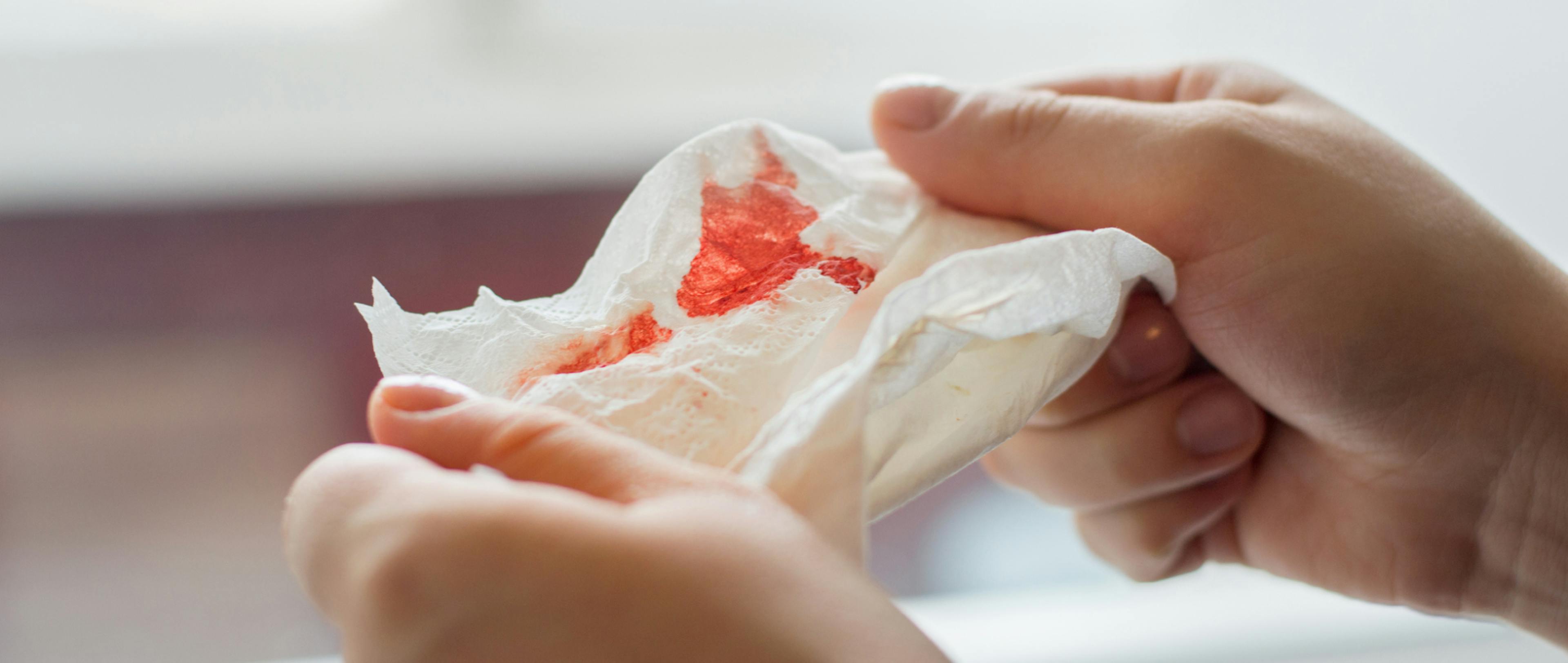 Are You Coughing Up Blood? Let’s Understand Hemoptysis