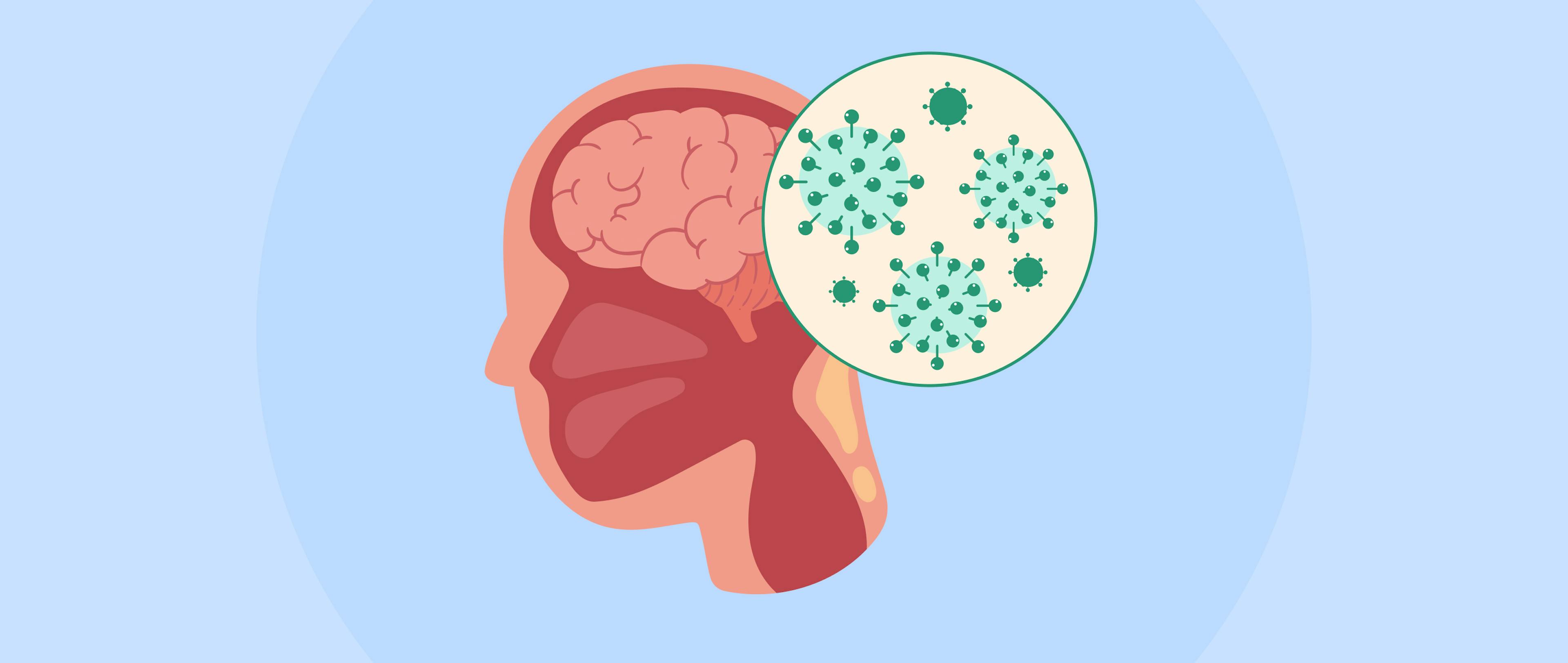 A pictorial representation of human brain with bacteria