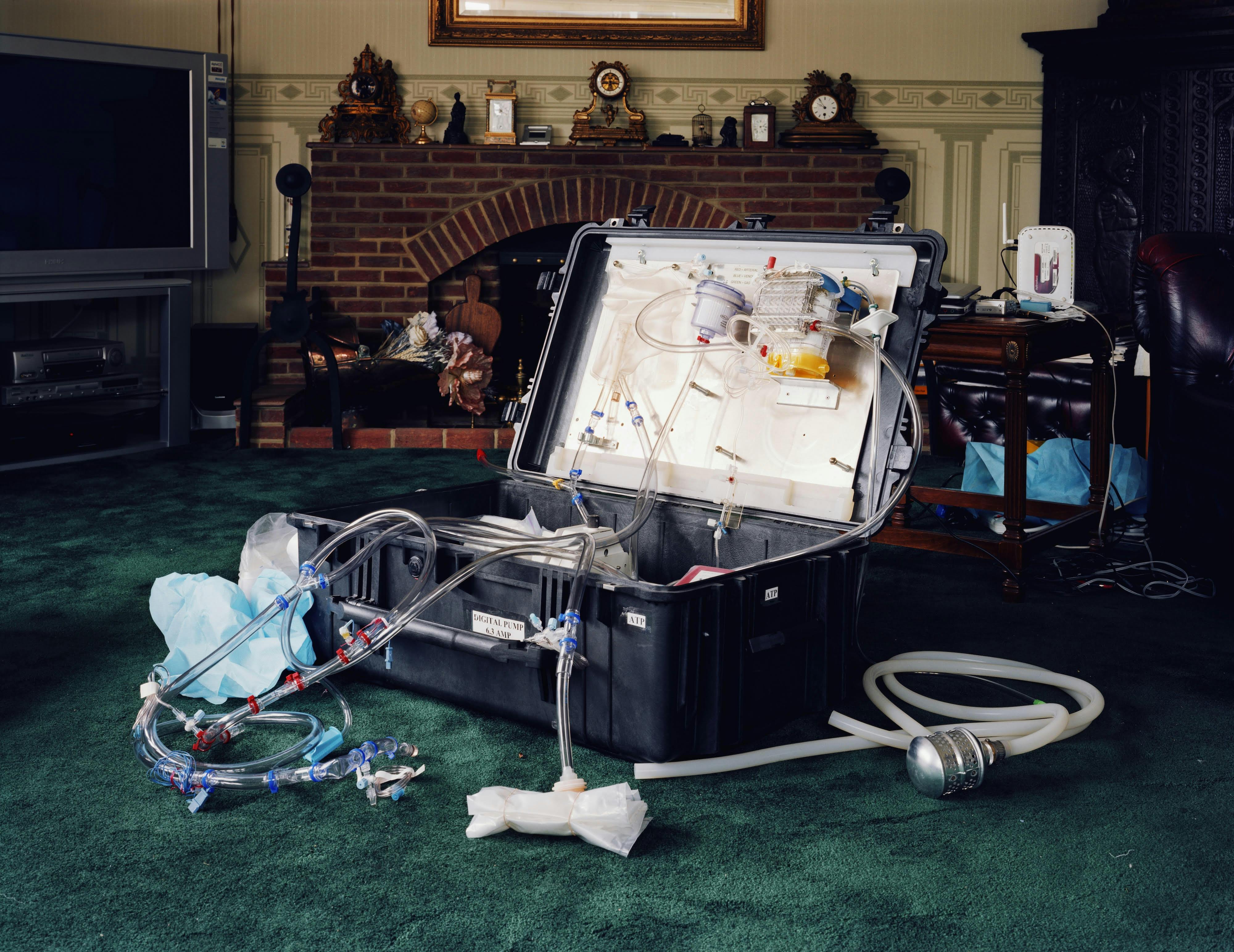 Suitcase overflowing with medical equipment, including tubes. 