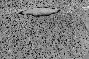 The cross-section of Vigna Mungo (Black gram/Urad Bean)