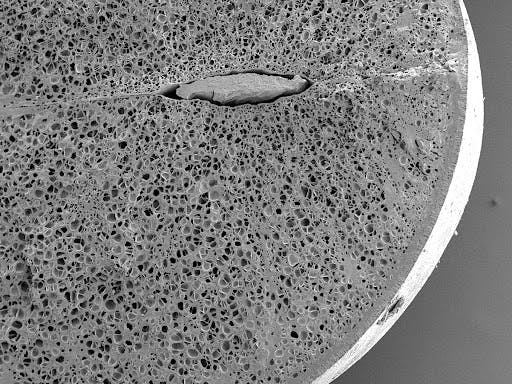 The cross-section of Vigna Mungo (Black gram/Urad Bean)