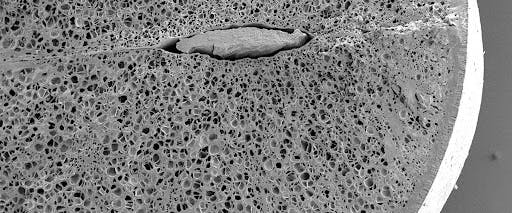 The cross-section of Vigna Mungo (Black gram/Urad Bean)