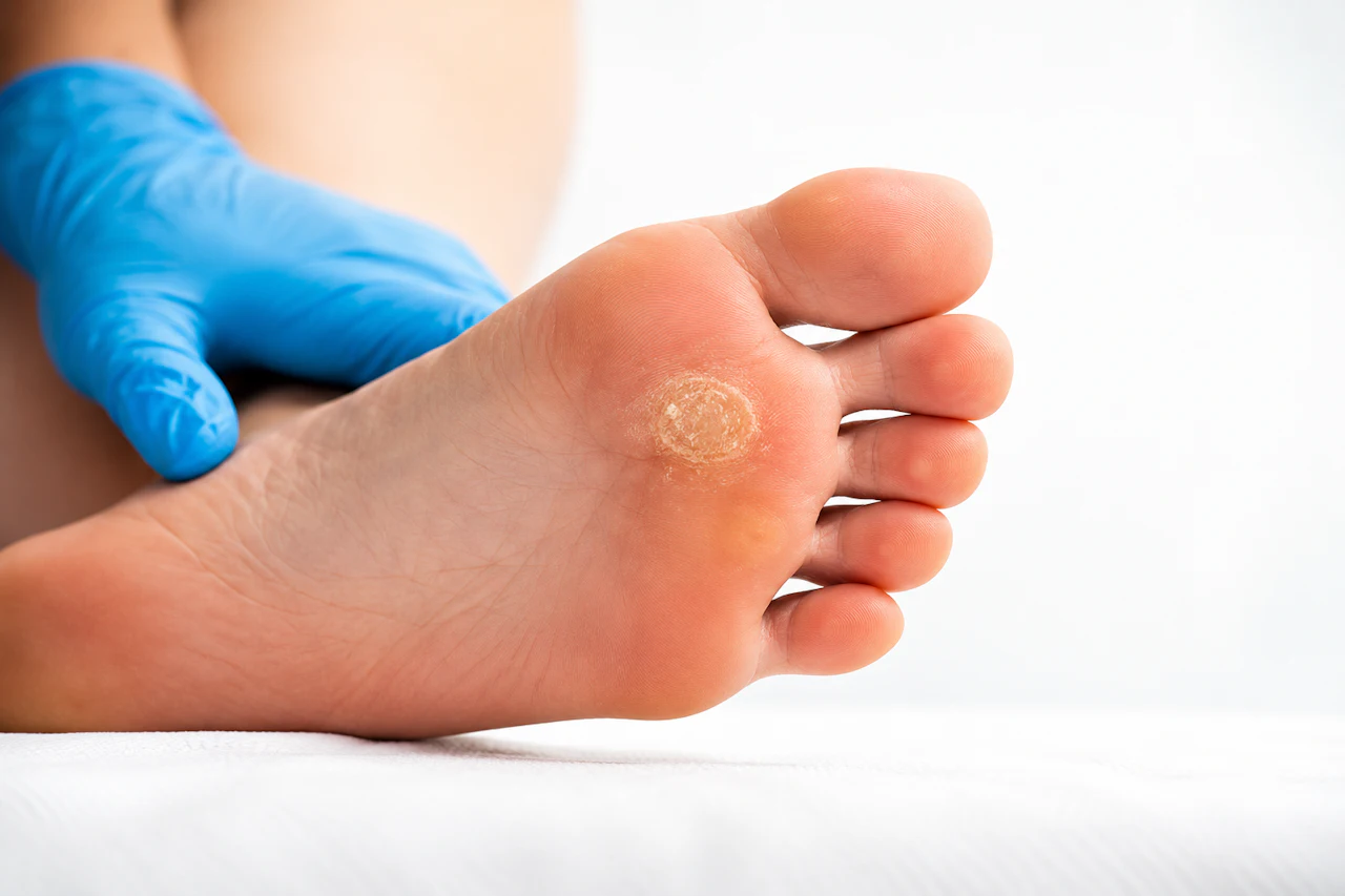 Common Foot Problems a Podiatrist Treats