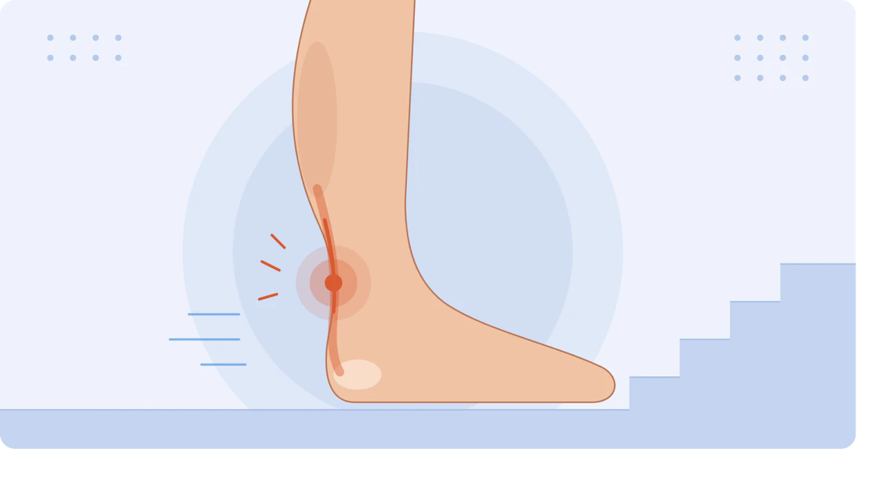 Illustration of a lower leg showing Achilles tendon pain above the heel, with stairs in the background.