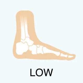 low foot profile - flat feet