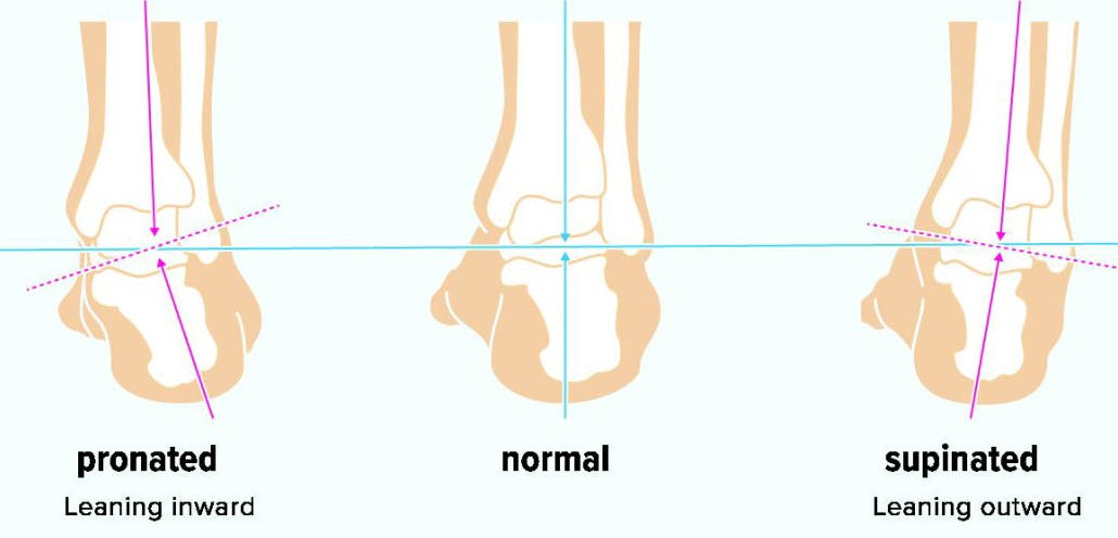 running orthotics