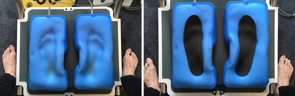Bespoke Hiking Orthotics from Foot Factor 