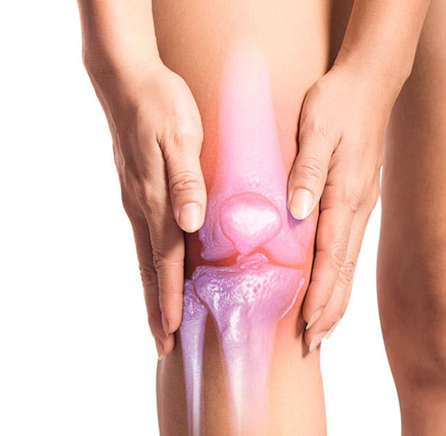ACL injury bespoke orhotics