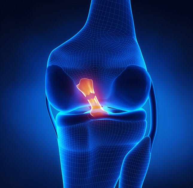 ACL injury recovery