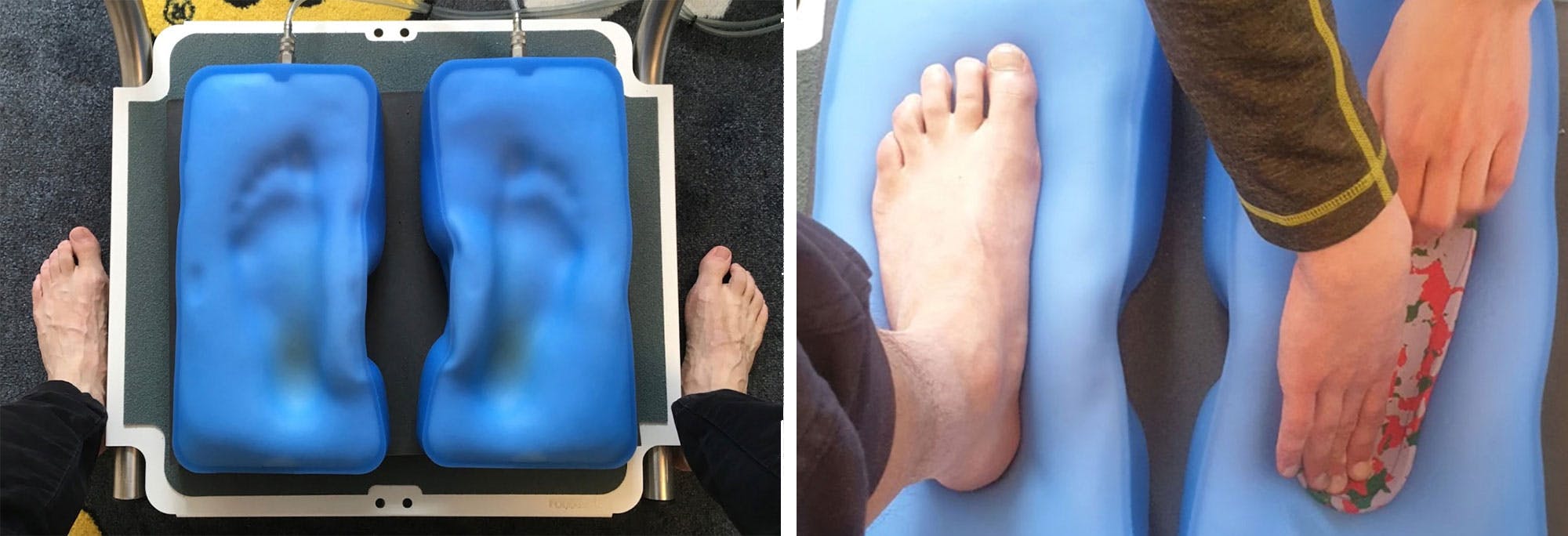 ski orthotics