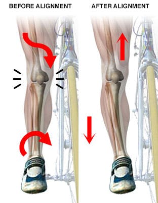 bespoke cycle orthotics for alignment