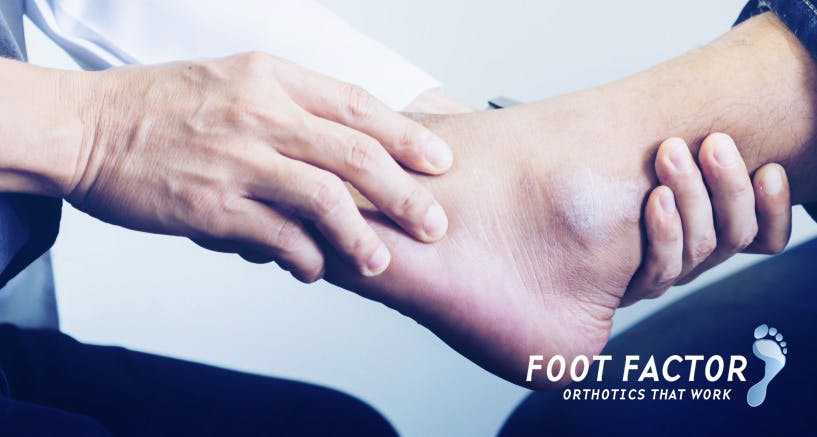Foot Factor - Matthew Collison