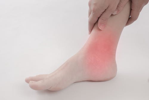Posterior Tibial Tendonitis | Foot Right Podiatry