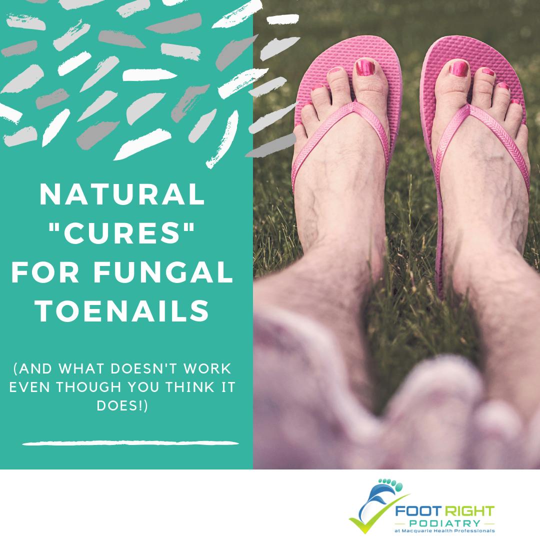 Natural Cures For Fungal Nails And What Actually Works Foot Right Podiatry