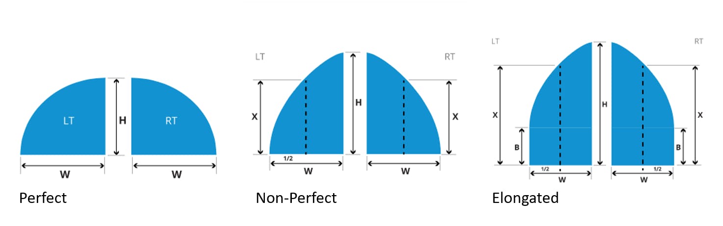 diagrams of perfect, non-perfect, and elongated quarter arches