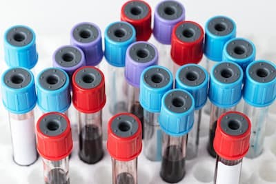 blood-sample-test-tube