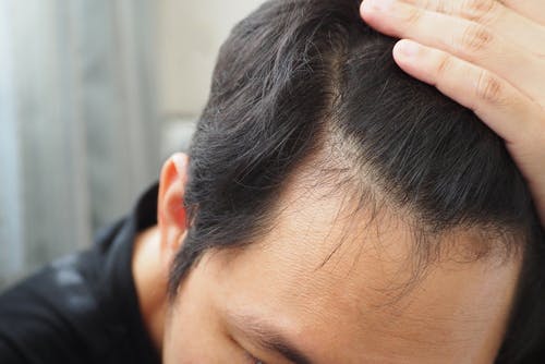 Collagen may help improve your hair
