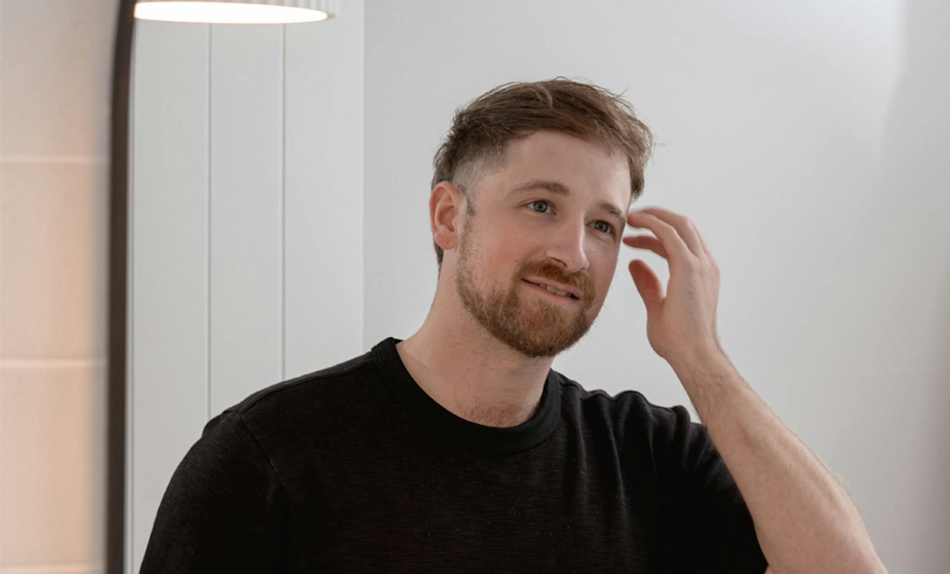 Male Pattern Baldness Treatments 