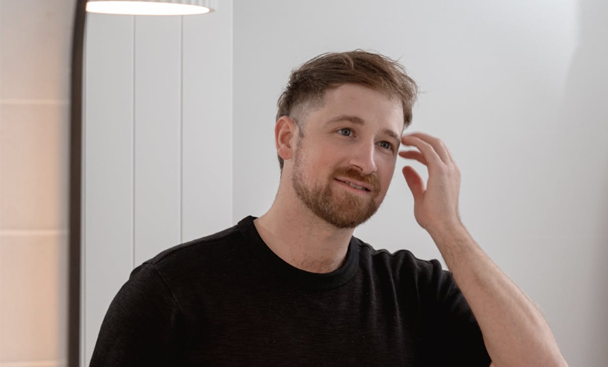 Hair Loss The Definitive Guide Mosh