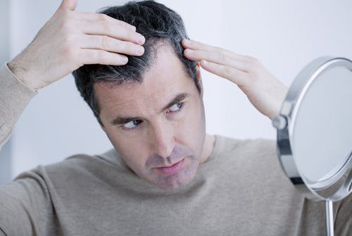 Man looking at his hairline in the mirror with concerns