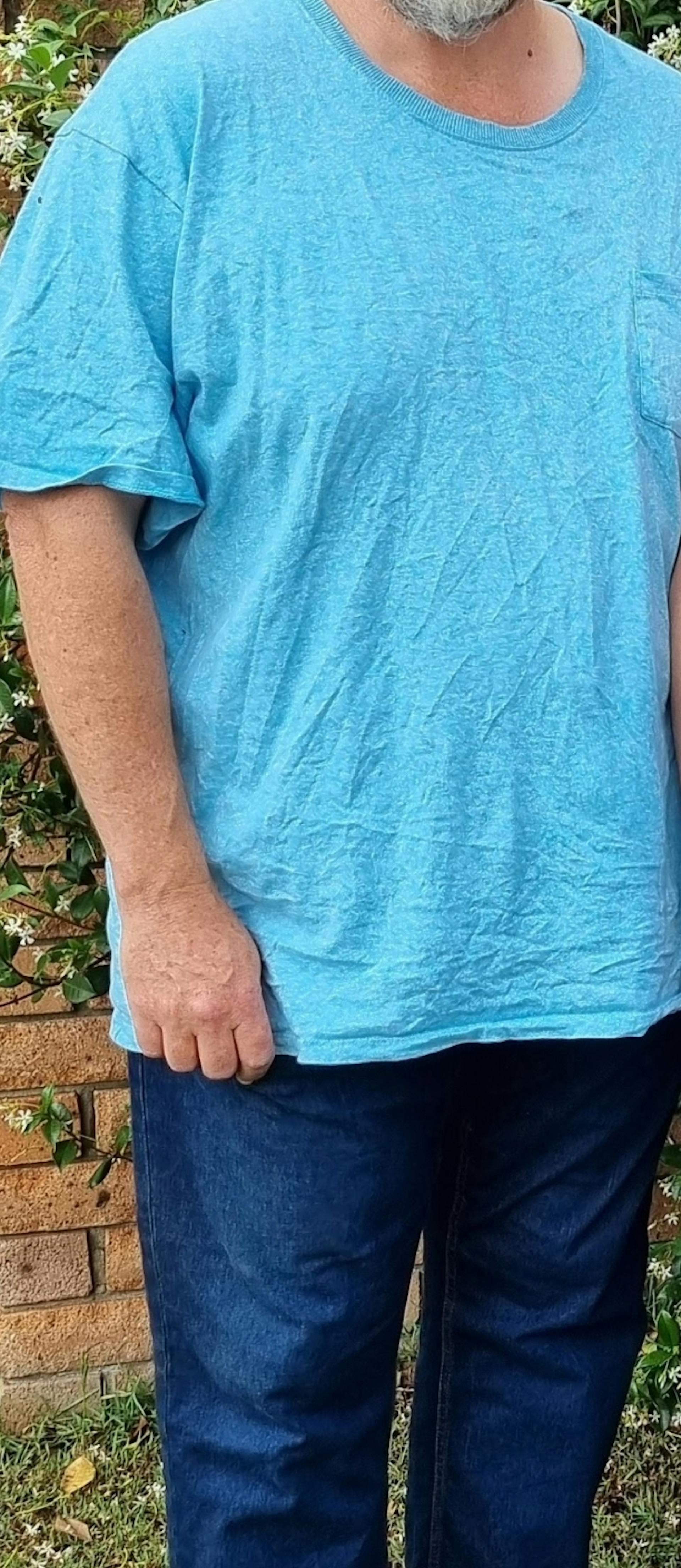 Steve after photo, weight loss treatment