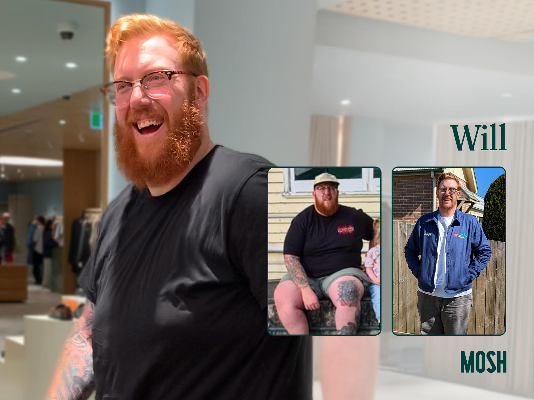 Mosh's weight loss treatment before and after - Will